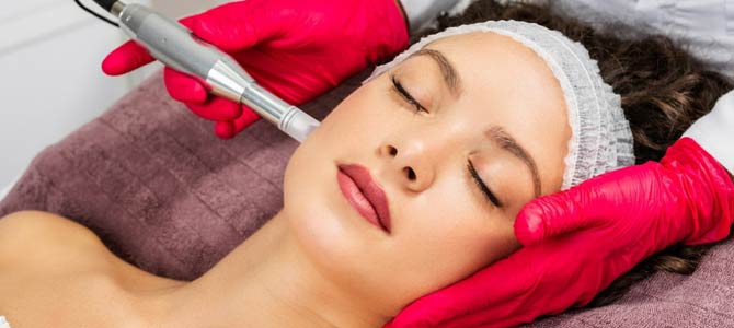 Microneedling Treatment Specialist Near Me in Colmar, PA