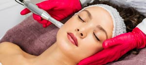 Microneedling Treatment Specialist Near Me in Colmar, PA