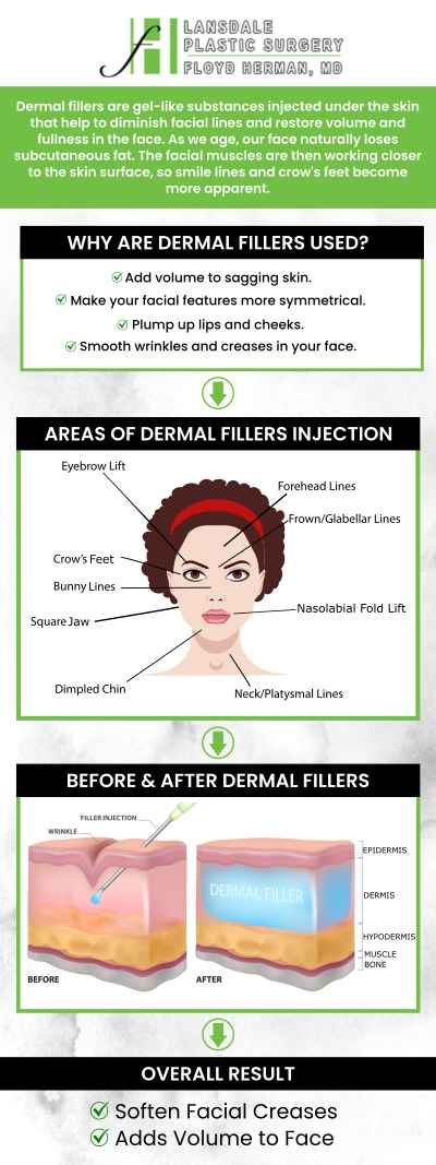 Dermal fillers are a great option for individuals looking to restore lost volume, smooth wrinkles, or enhance facial contours. A good candidate for dermal fillers is typically someone in good overall health who has realistic expectations about the results. Dr. Floyd Herman at Lansdale Plastic Surgery will carefully evaluate your skin and aesthetic goals to determine if dermal fillers are the right choice for you. For more information, feel free to contact us or request an appointment online. We are conveniently located at 2405 North Broad Street, Colmar, PA 18915. Dermal fillers are a great option for individuals looking to restore lost volume, smooth wrinkles, or enhance facial contours. A good candidate for dermal fillers is typically someone in good overall health who has realistic expectations about the results. Dr. Floyd Herman at Lansdale Plastic Surgery will carefully evaluate your skin and aesthetic goals to determine if dermal fillers are the right choice for you. For more information, feel free to contact us or request an appointment online. We are conveniently located at 2405 North Broad Street, Colmar, PA 18915.