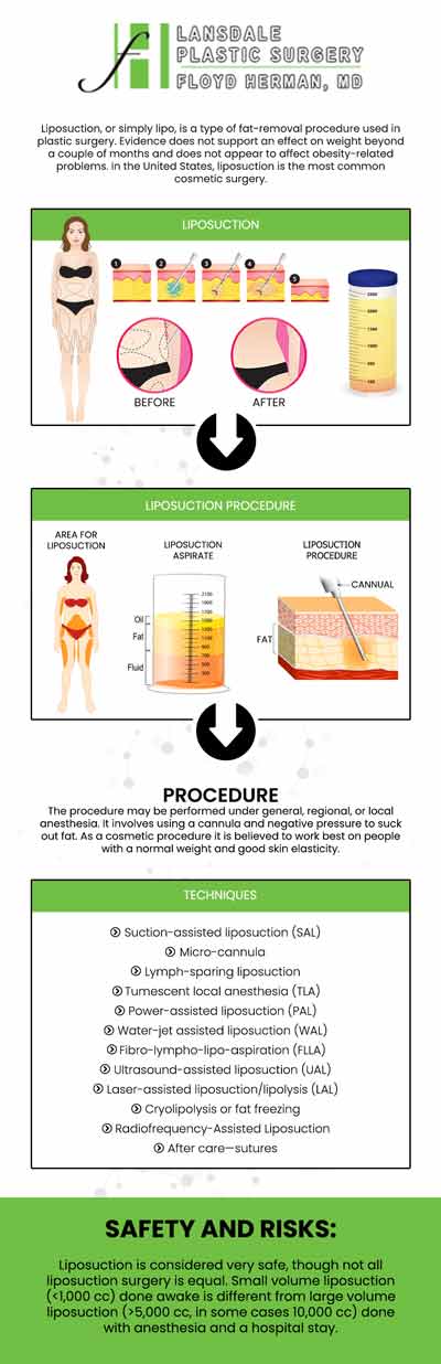 Liposuction is a surgical procedure that involves the removal of excess fat from specific areas of the body, such as the abdomen, thighs, hips, buttocks, arms, or neck. The procedure is usually done under local anesthesia. Liposuction treatment is available at Lansdale Plastic Surgery Center. For more information, feel free to contact us or request an appointment online. We are conveniently located at 2405 North Broad Street, Colmar, PA 18915.