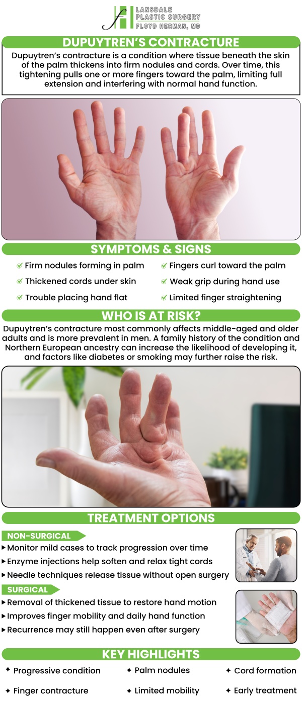 Common questions asked by clients: What is the main cause of Dupuytren's contracture? Where does Dupuytren's disease come from? What happens if you don't treat Dupuytren's contracture? What is the newest treatment for Dupuytren's contracture? For more information, contact us today or book an appointment online. Visit us online now to meet your team! We are conveniently located at 2405 North Broad Street, Colmar, PA 18915. We serve clients from Colmar PA, Montgomeryville PA, Lansdale PA, Skippack PA, Harleysville PA, Hatfield PA, Blue Bell PA, and surrounding areas!